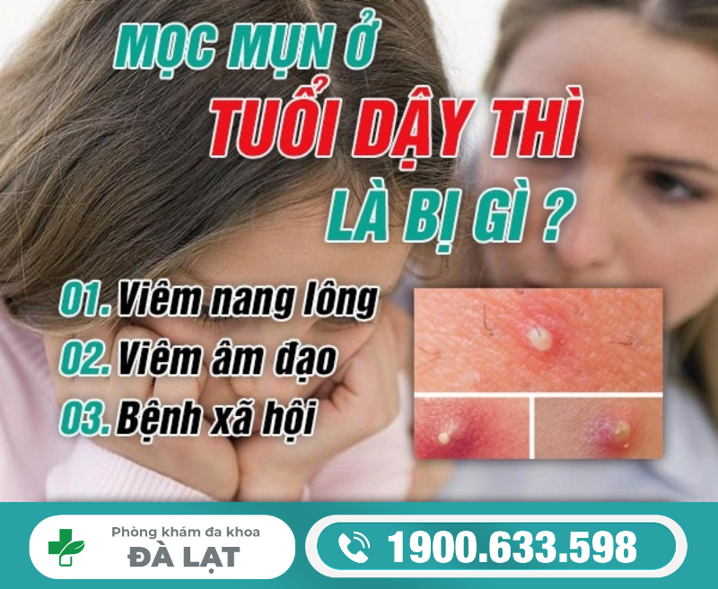 Hình ảnh minh họa